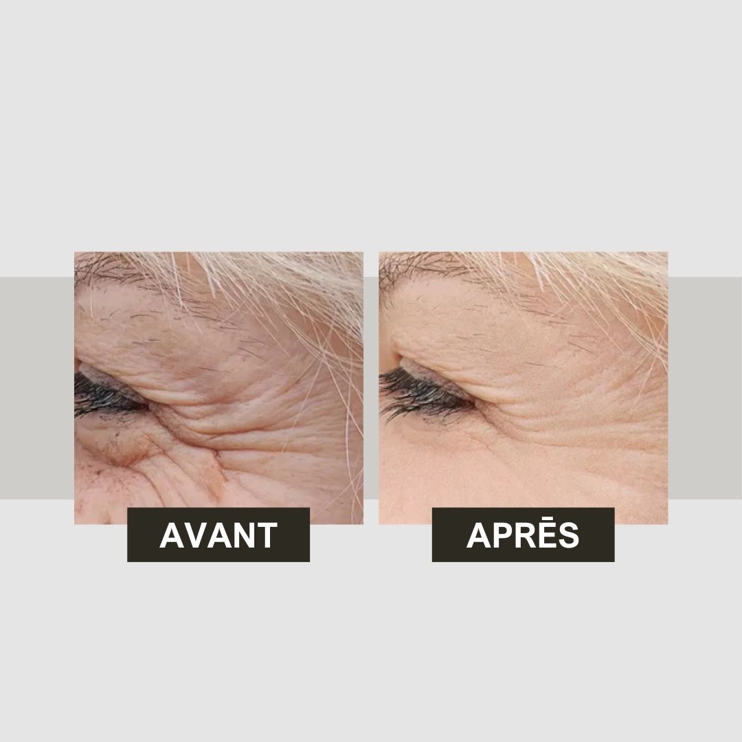 Comparaison avant-après. Contour des yeux avec rides. Texte: Avant, Après.