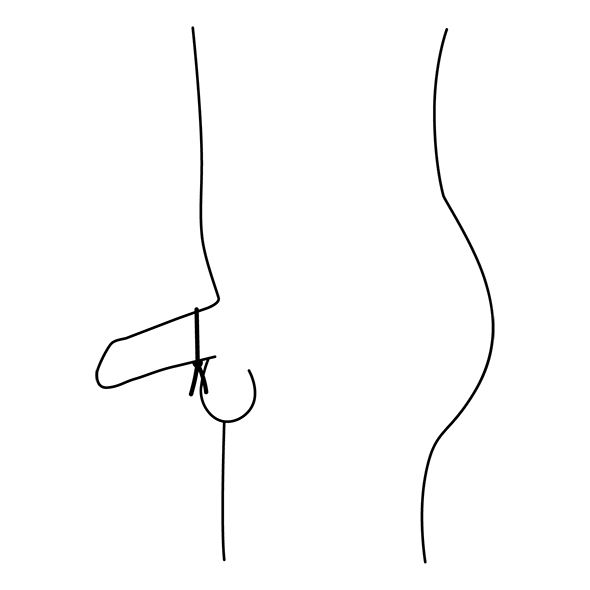 Schwarz, verstellbarer Cockring, schematische Darstellung. Um den Penis und Hoden gelegt.