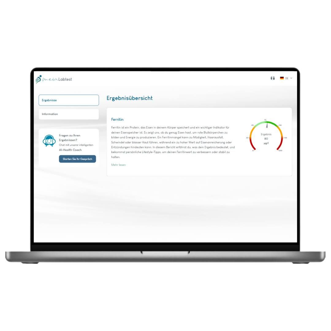 Laptop mit Ergebnisübersicht. Anzeige von Testergebnissen. Logo von meinLabtest.de.