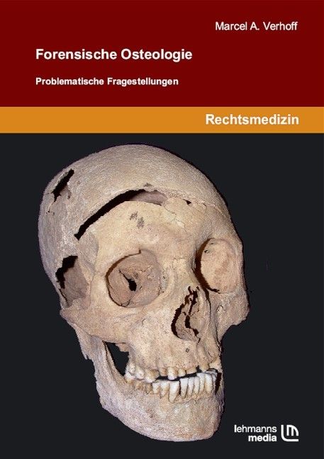 Buchcover mit Schädel. Titel: Forensische Osteologie. Autor: Marcel A. Verhoff. Verlag: Lehmanns Media. Fachgebiet: Rechtsmedizin.