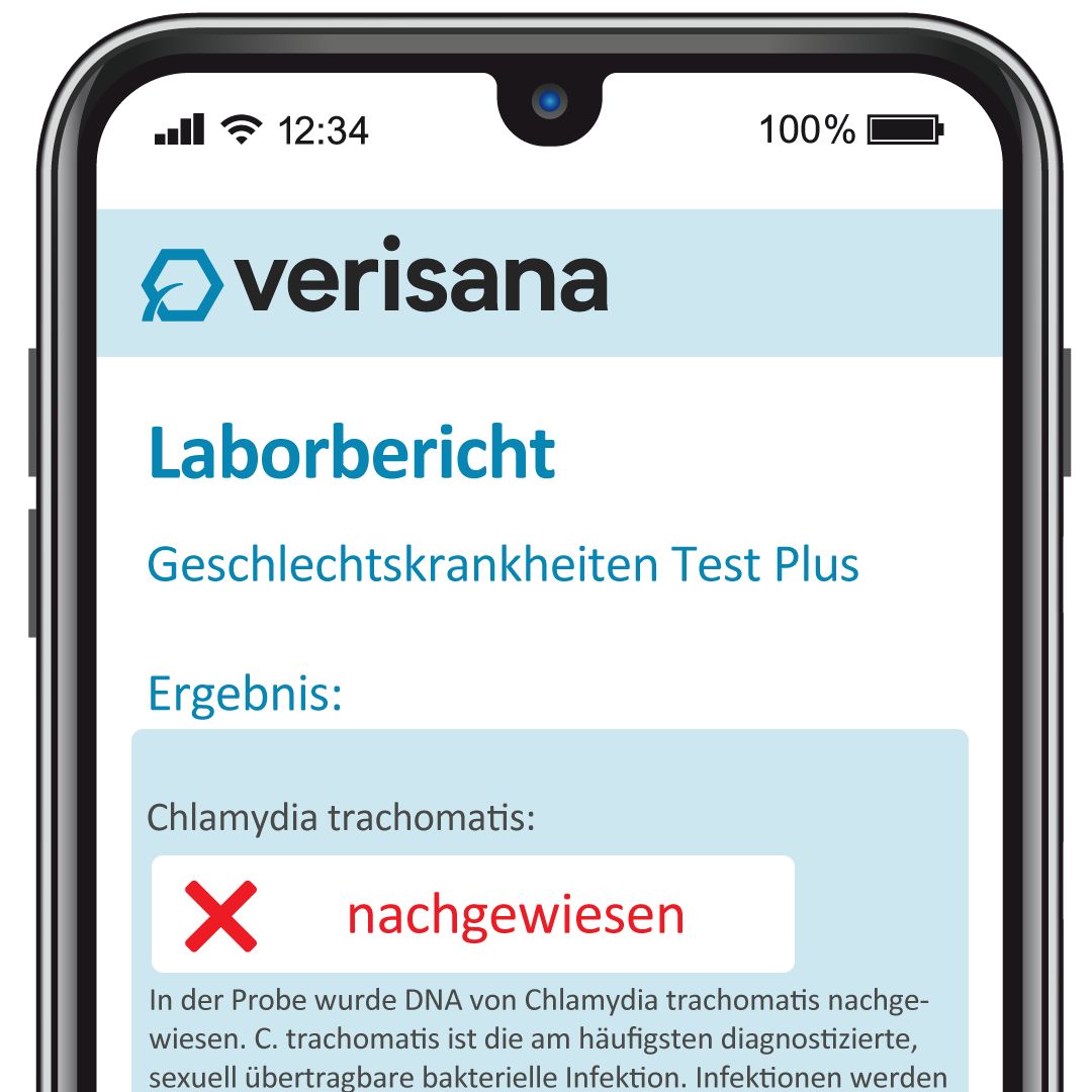 Verisana Geschlechtskrankheiten Test Plus für Männer 1 St