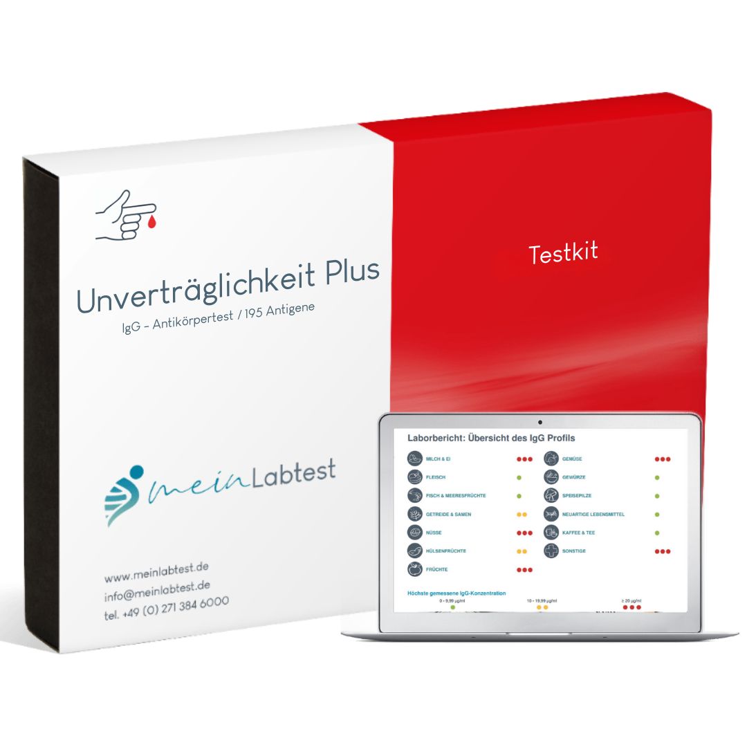 Testkit für Lebensmittelunverträglichkeit. Weiß-roter Karton mit Produktnamen und Logo. Tablet mit Testergebnissen.