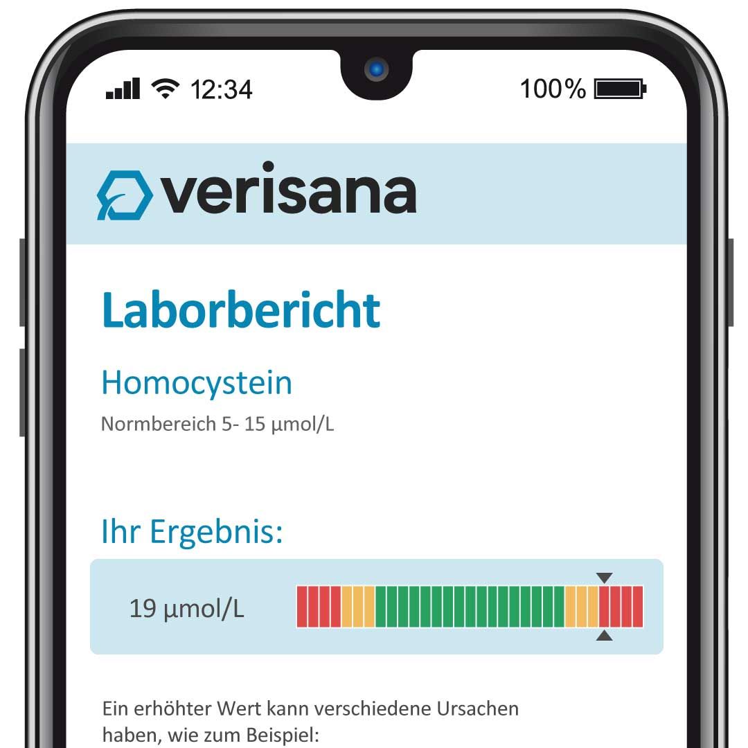 Verisana Homocystein Test