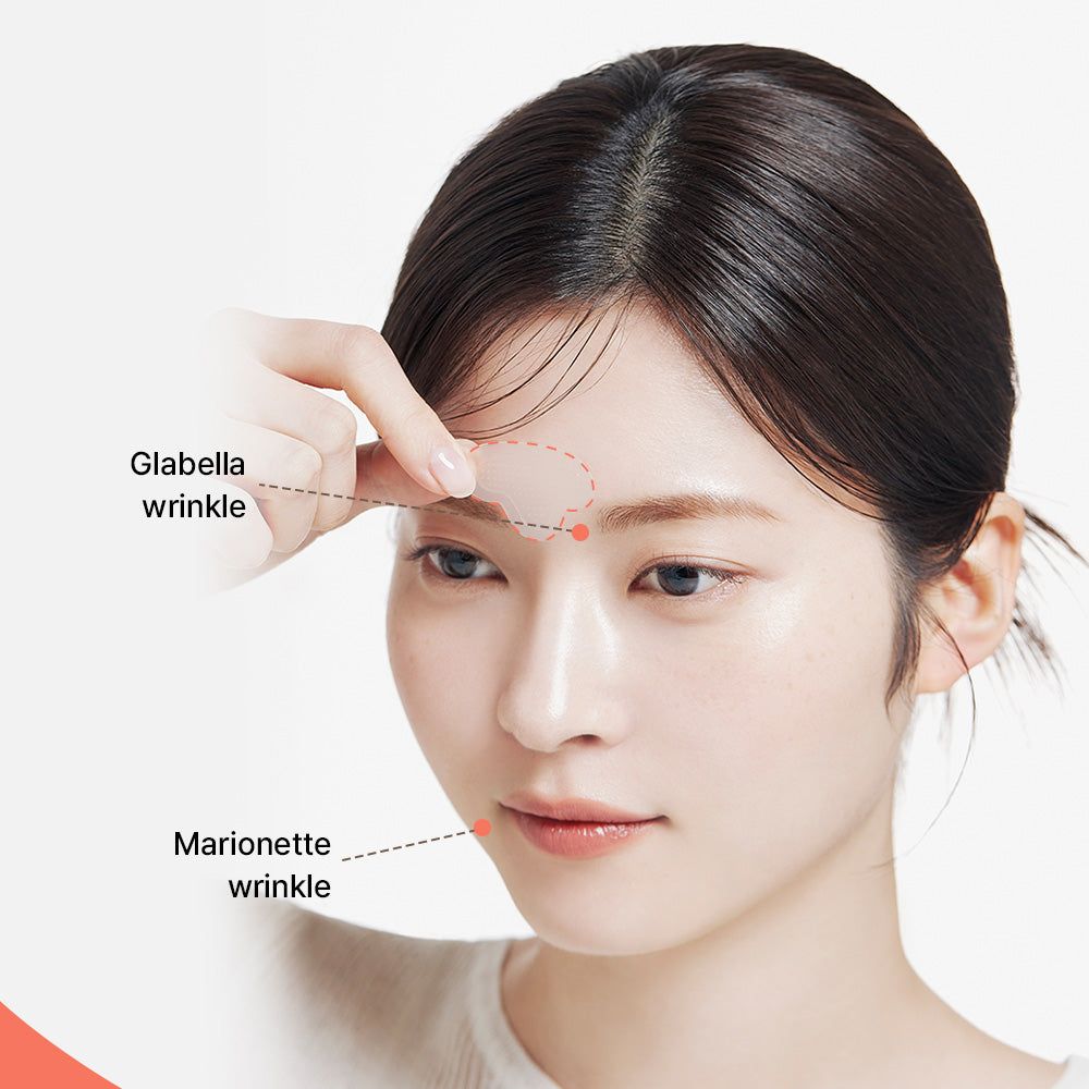 Transparenter Patch zur Glättung von Stirnfalten, wird auf die Glabella-Region aufgetragen.