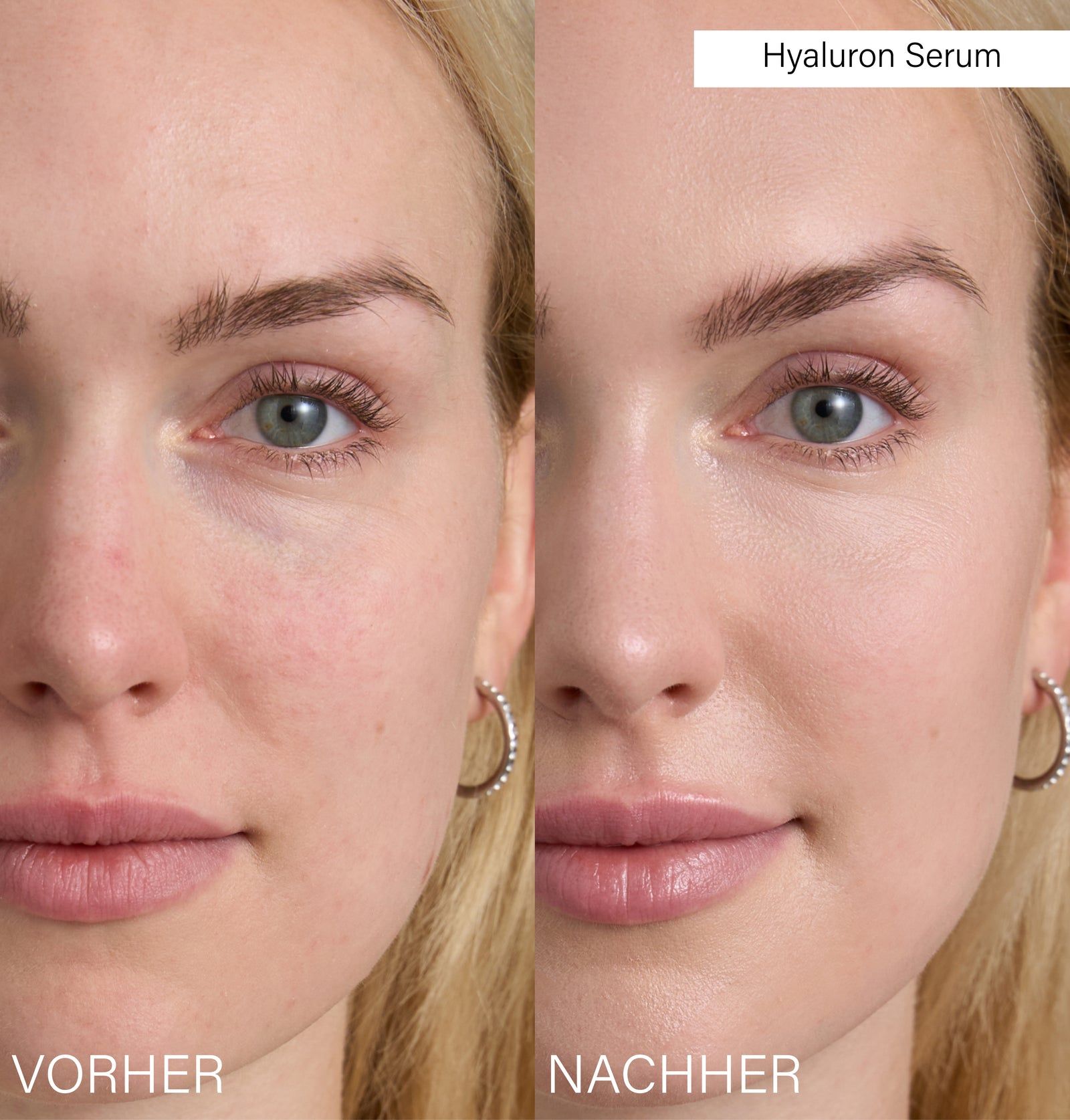 Rosental Organics Hyaluron Serum