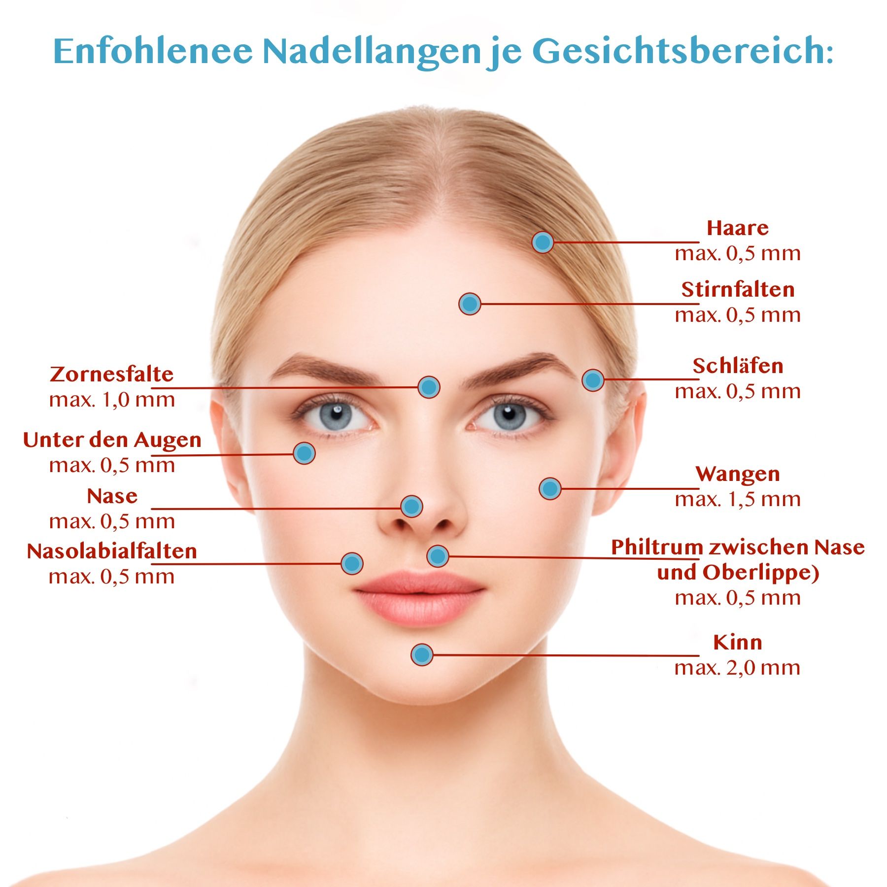Gesicht mit Markierungen für empfohlene Nadellängen. Bereiche: Stirn, Augen, Nase, Wangen, Kinn.