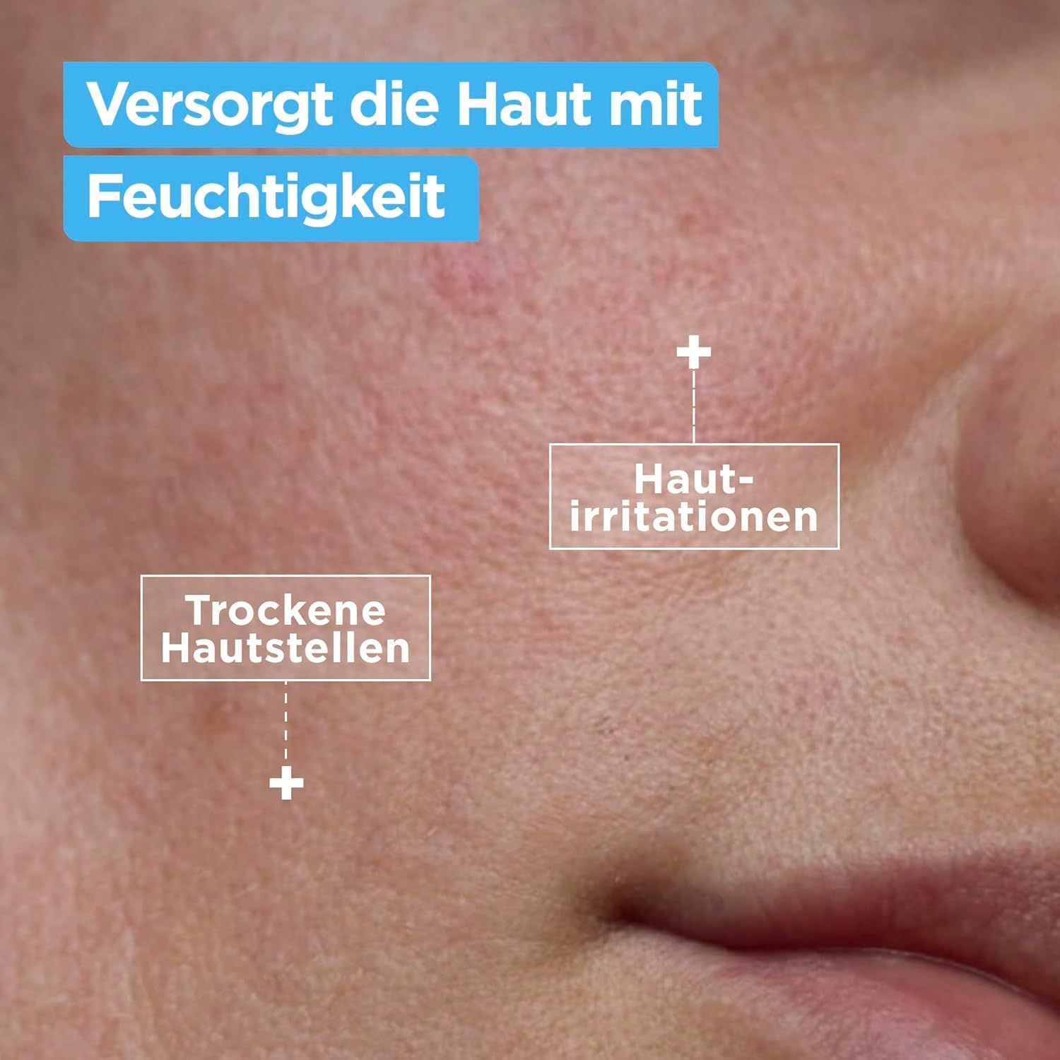 Nahaufnahme von Haut mit Markierungen. Text: Trockene Hautstellen, Hautirritationen. Überschrift: Versorgt die Haut mit Feuchtigkeit.