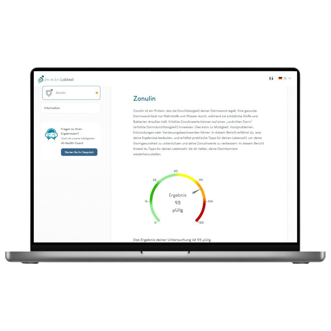 Laptop mit Testergebnissen. Auf dem Bildschirm: Zonulin-Informationen und Ergebnis-Diagramm. Logo: meinLabtest.
