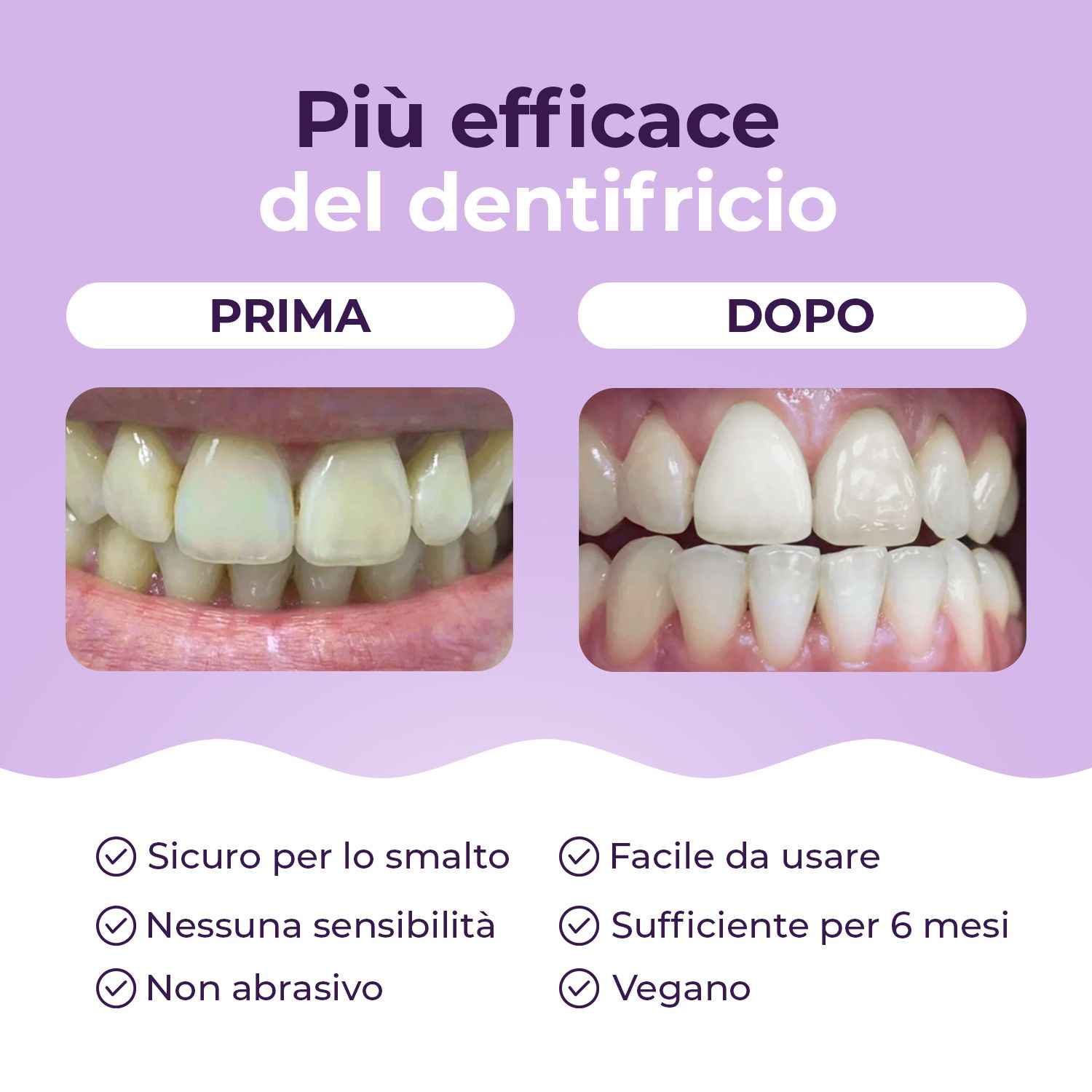Confronto prima-dopo dei denti. Vantaggi: sicuro, nessuna sensibilità, non abrasivo, vegano.