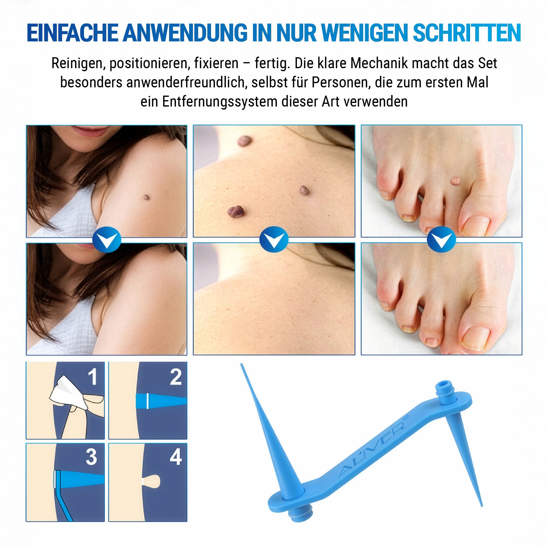 Illustrationen der Anwendungsschritte. Text: EINFACHE ANWENDUNG IN NUR WENIGEN SCHRITTEN. Blauer Applikator.