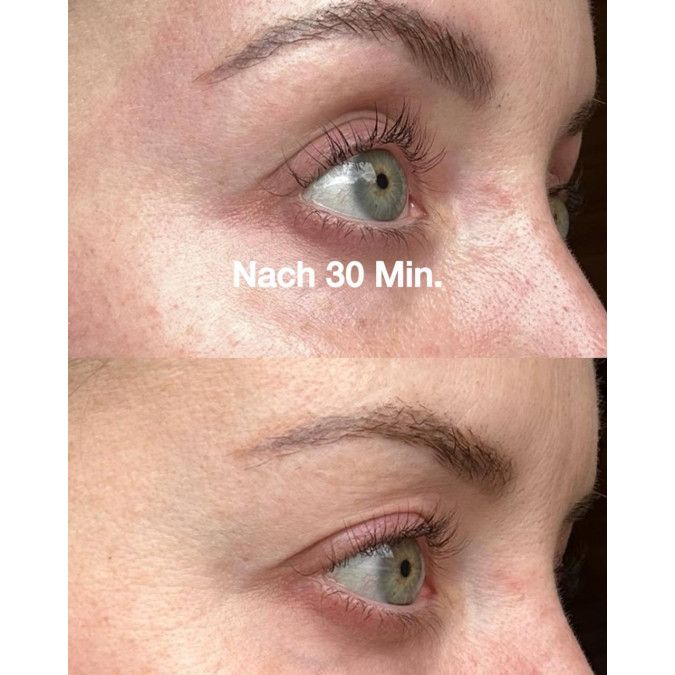 Zwei Nahaufnahmen eines Auges. Links: Haut mit Falten. Rechts: Haut glatter. Text: Nach 30 Min.