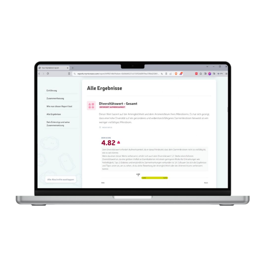 Laptop mit Webseite. Text: Alle Ergebnisse. Diagramm mit Diversitätswert. Text auf der linken Seite.