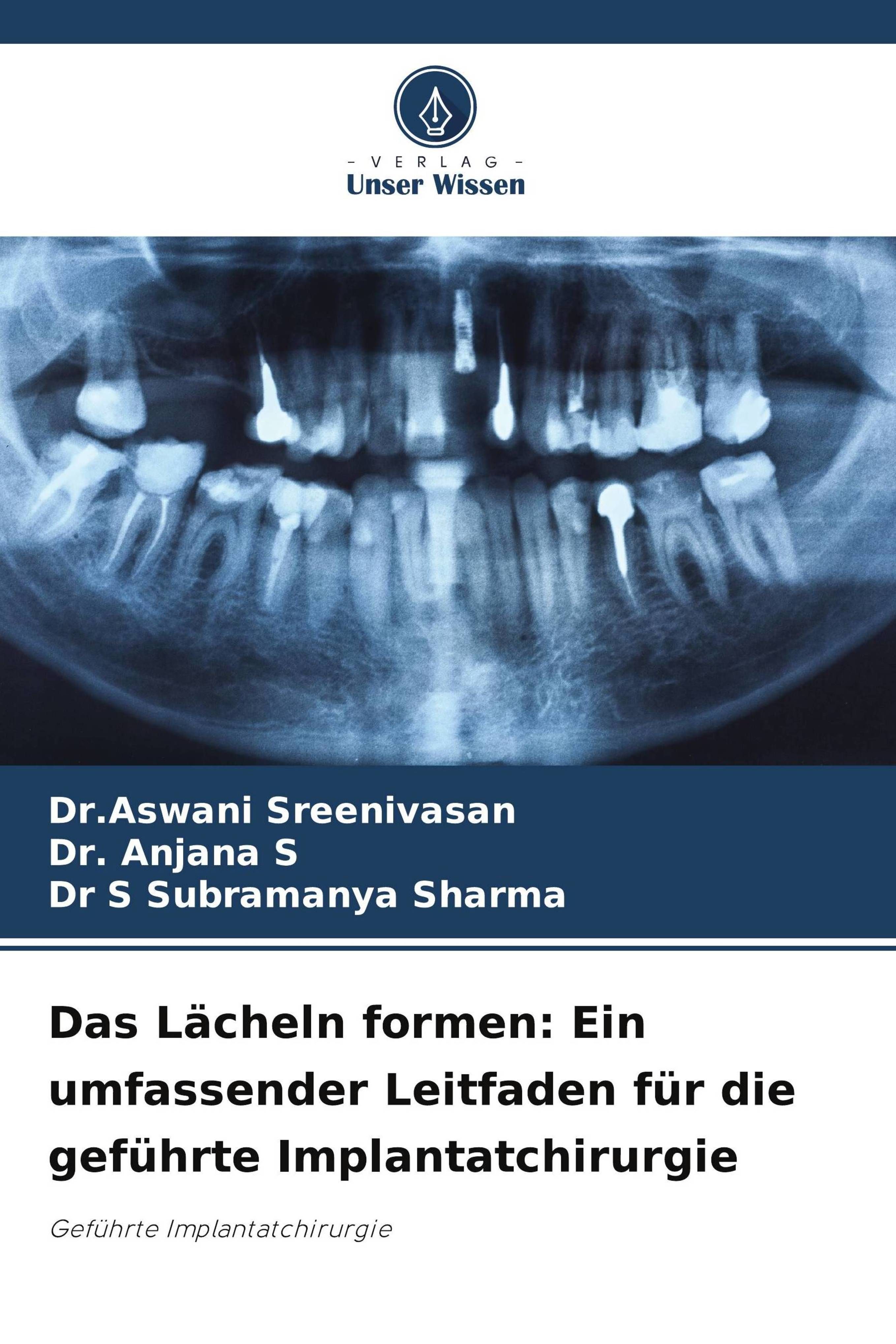 Das Lächeln formen: Ein umfassender Leitfaden für die geführte Implantatchirurgie Geführte Implan...