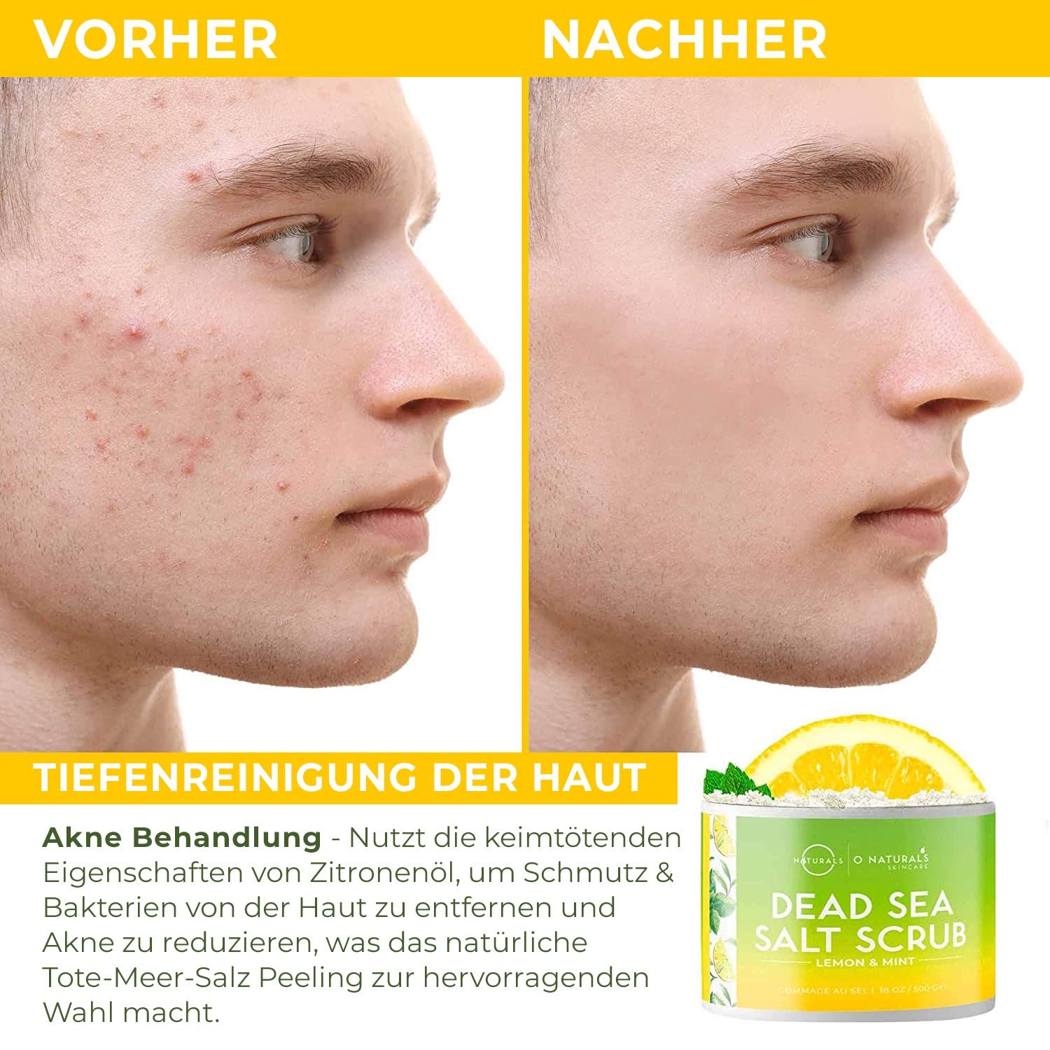 NATURALS Körperpeeling Body Scrub Lemon Mint - Natürliches Körperpeeling mit Totem Meer Salz