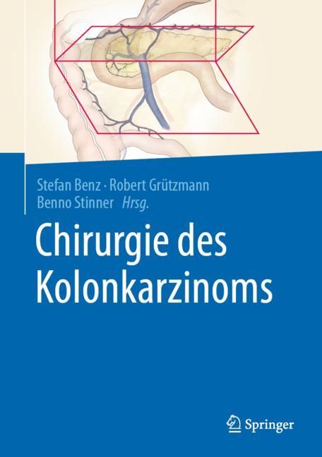 Buchcover mit Titel "Chirurgie des Kolonkarzinoms". Autoren: Benz, Grützmann, Stinner. Verlag Springer. Illustration des Darms.