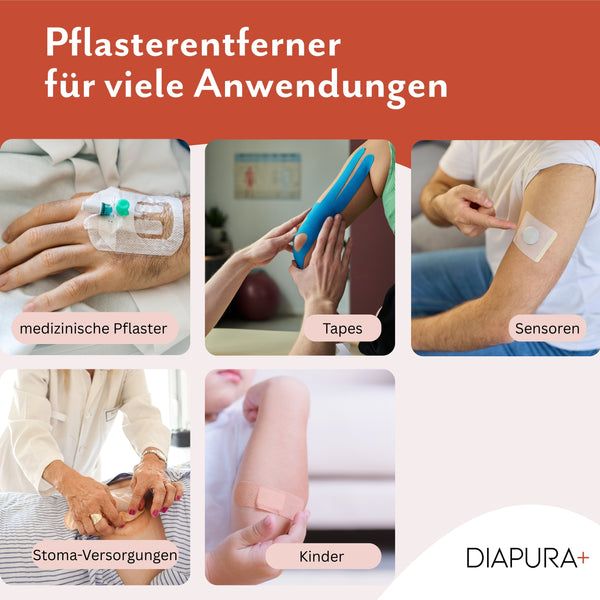 DIAPURA Pflasterentferner Spray, alkoholfrei, für Pflaster, Tapes, Stoma, Sensoren & Katheter