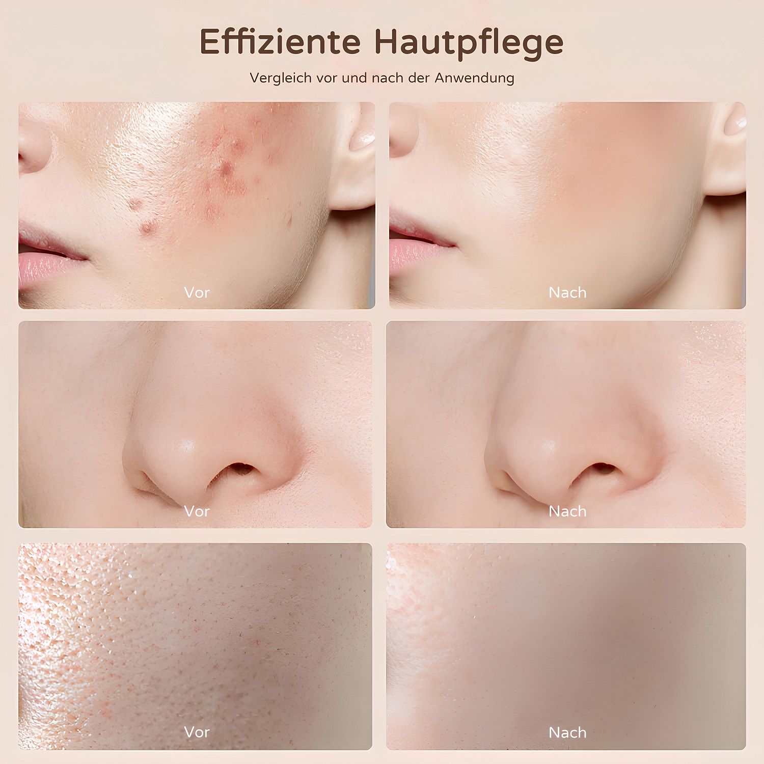 COOL-i LED Gesichtsmaske,4 Lichtfarben,Infrarot,kabellos, mit 10 Min.Timer