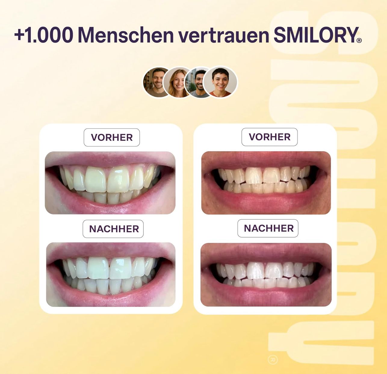 Vorher-Nachher-Vergleich von Zahnaufhellungsergebnissen mit Smilory.