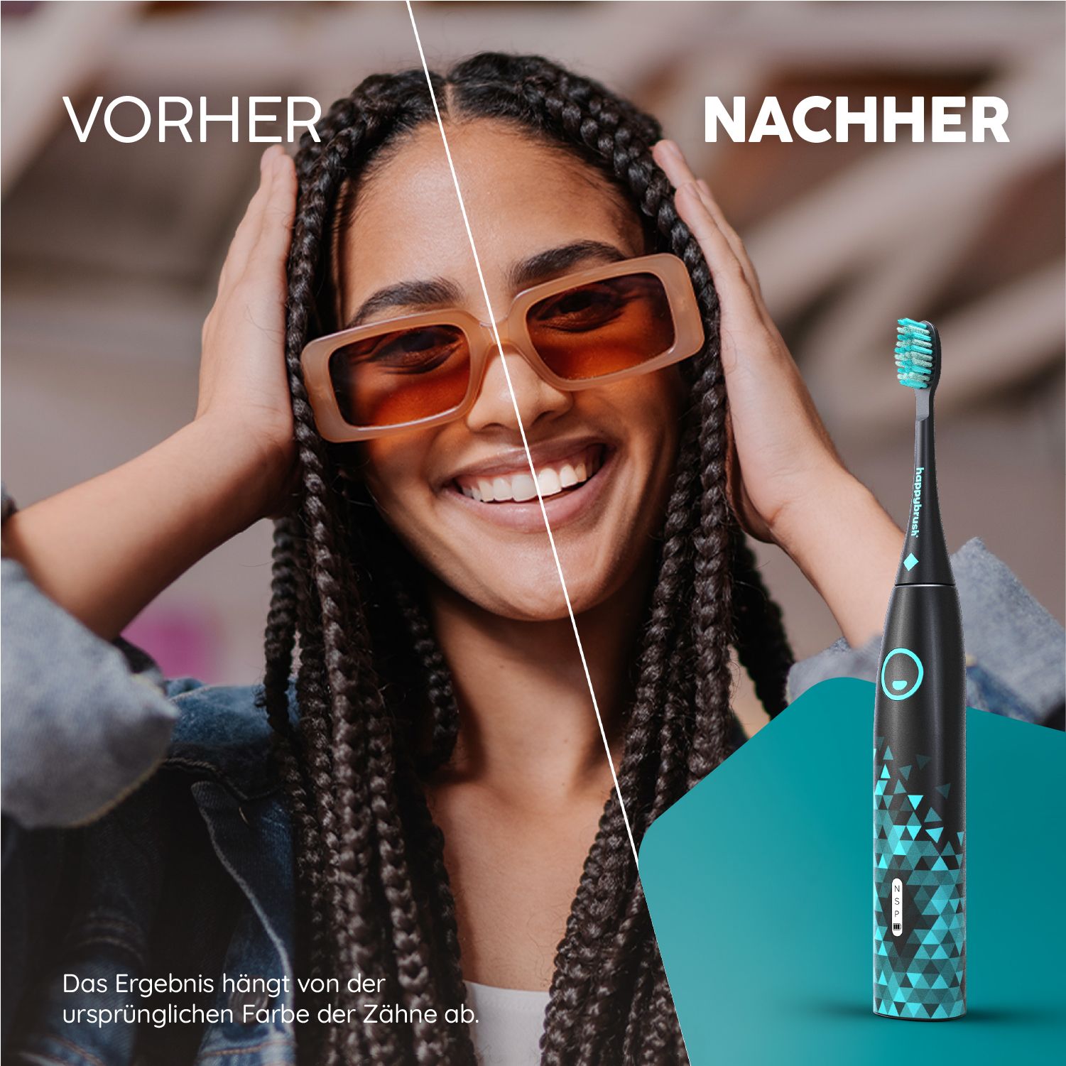 Vorher-Nachher-Vergleich. Frau mit Sonnenbrille und Zöpfen. Rechts: Frau mit weißeren Zähnen und Zahnbürste. Text: Das Ergebnis hängt von der Zahnfarbe ab.