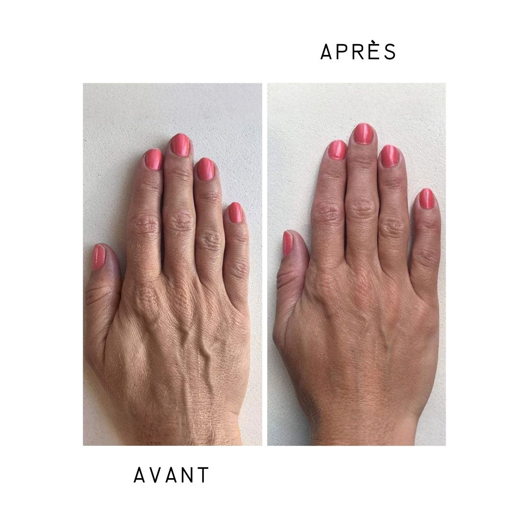 Deux mains, une avant, une après utilisation. Ongles rouges. Amélioration de la peau.