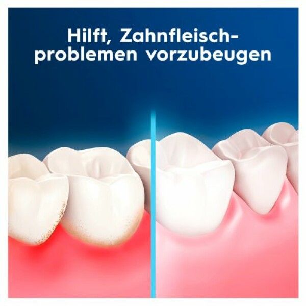 Zahndarstellung: Zähne vor und nach der Reinigung. Text: Hilft, Zahnfleischproblemen vorzubeugen.