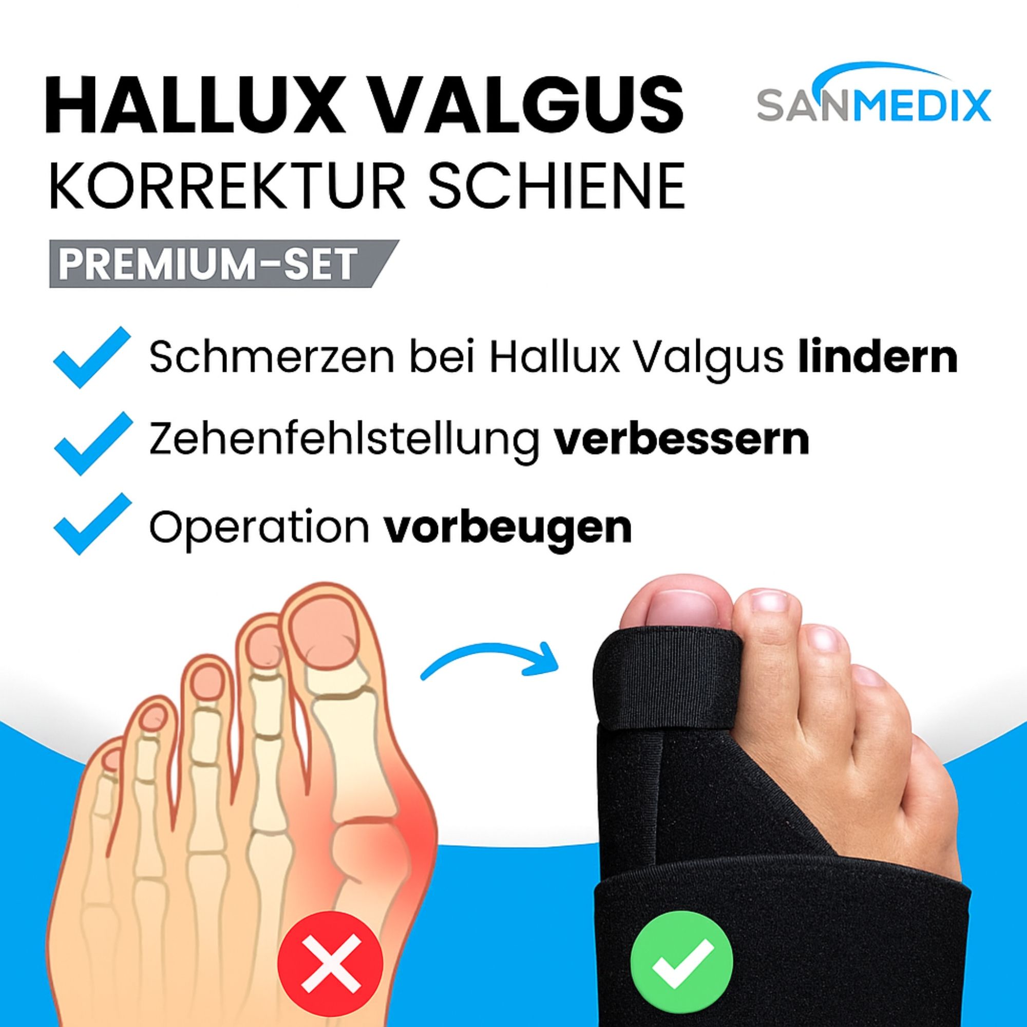 Infografik: Hallux Valgus Korrektur Schiene. Sanmedix® Logo. Vorteile: Schmerzen lindern, Fehlstellung verbessern, Operation vorbeugen. Fuß mit Schiene.