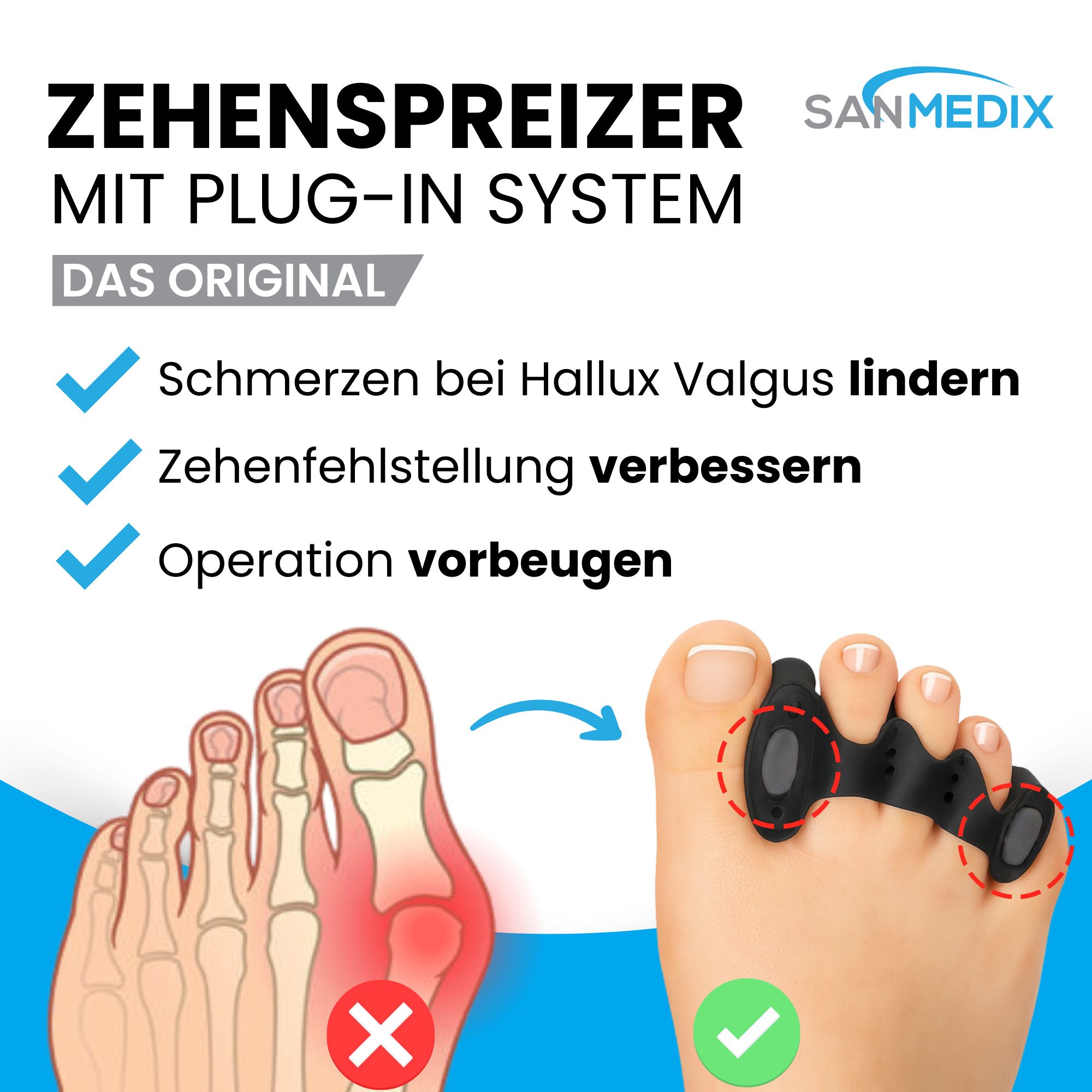 Schwarzer Zehenspreizer mit Plug-In System. Text: Schmerzen lindern, Fehlstellung verbessern, Operation vorbeugen. Sanmedix Logo.