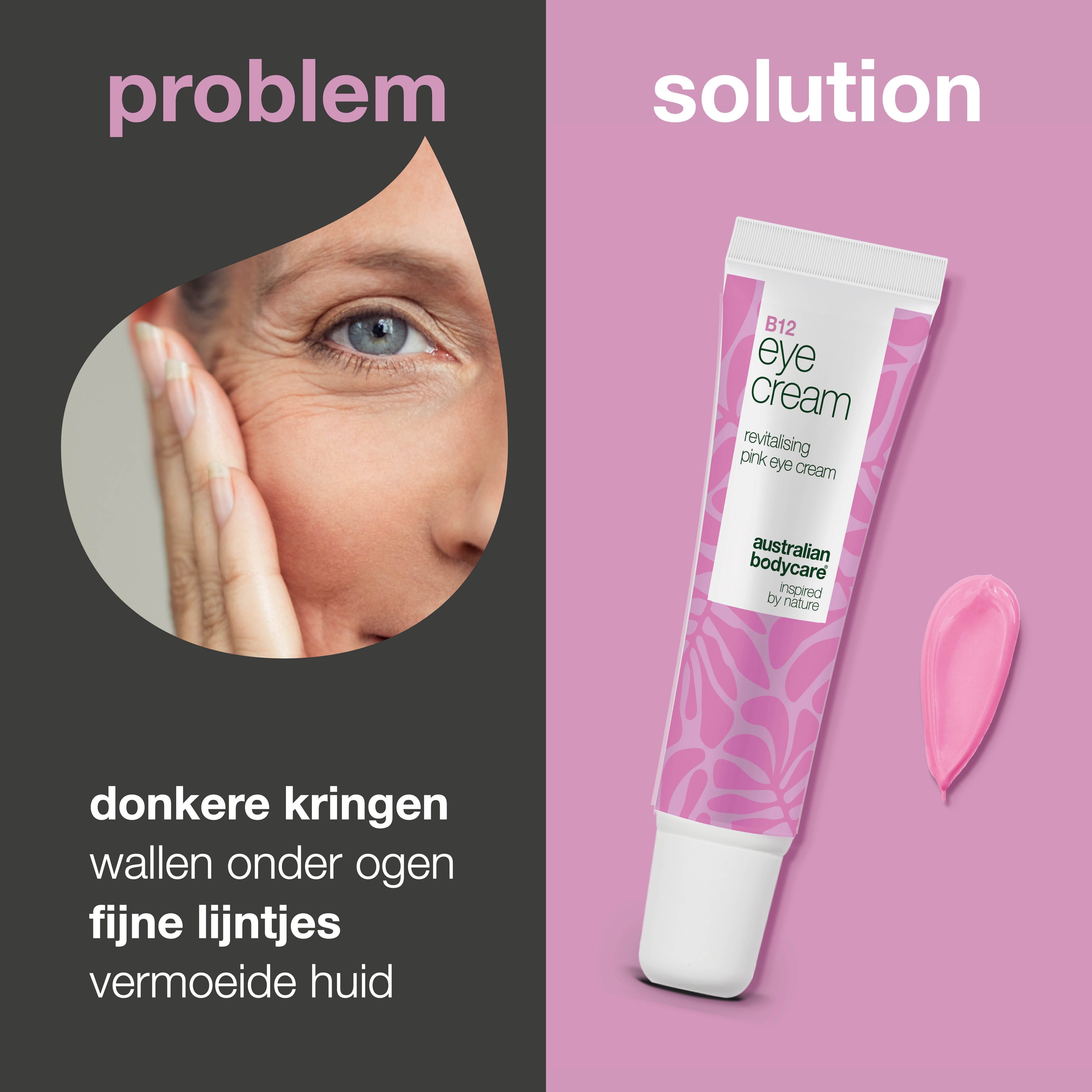Gezicht met oogcontour. Daarnaast tube oogcrème en klodder. Tekst: donkere kringen, wallen, fijne lijntjes, vermoeide huid.