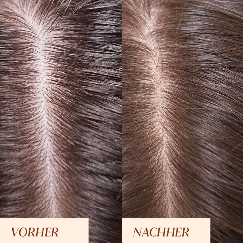 Zwei Ansichten von Kopfhaut. Links: Vorher, dunkles Haar. Rechts: Nachher, dunkles Haar. Unterschiede in der Textur und dem Aussehen der Kopfhaut.