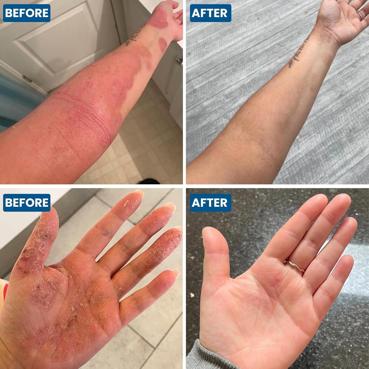 Grahams Natural C+ Ekzem Creme