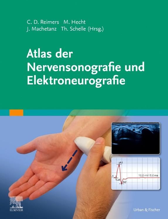 Buchcover: Atlas der Nervensonografie und Elektroneurografie. Hände mit Ultraschallgerät, Diagramm, Ultraschallbild. Verlag Urban & Fischer, Elsevier.