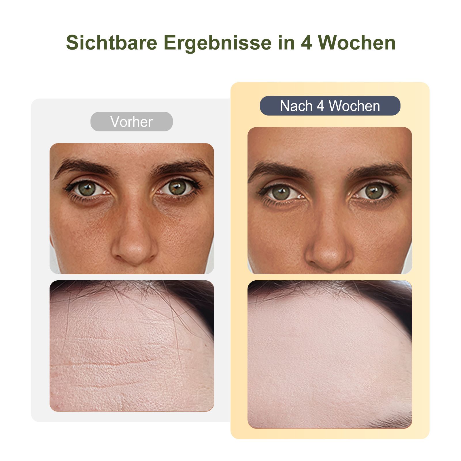 COOL-i 2MHz RF & EMS Gesichtsmassagegerät 6in1 Hautverjüngung mit Ultraschall, Licht & Kühlmodus