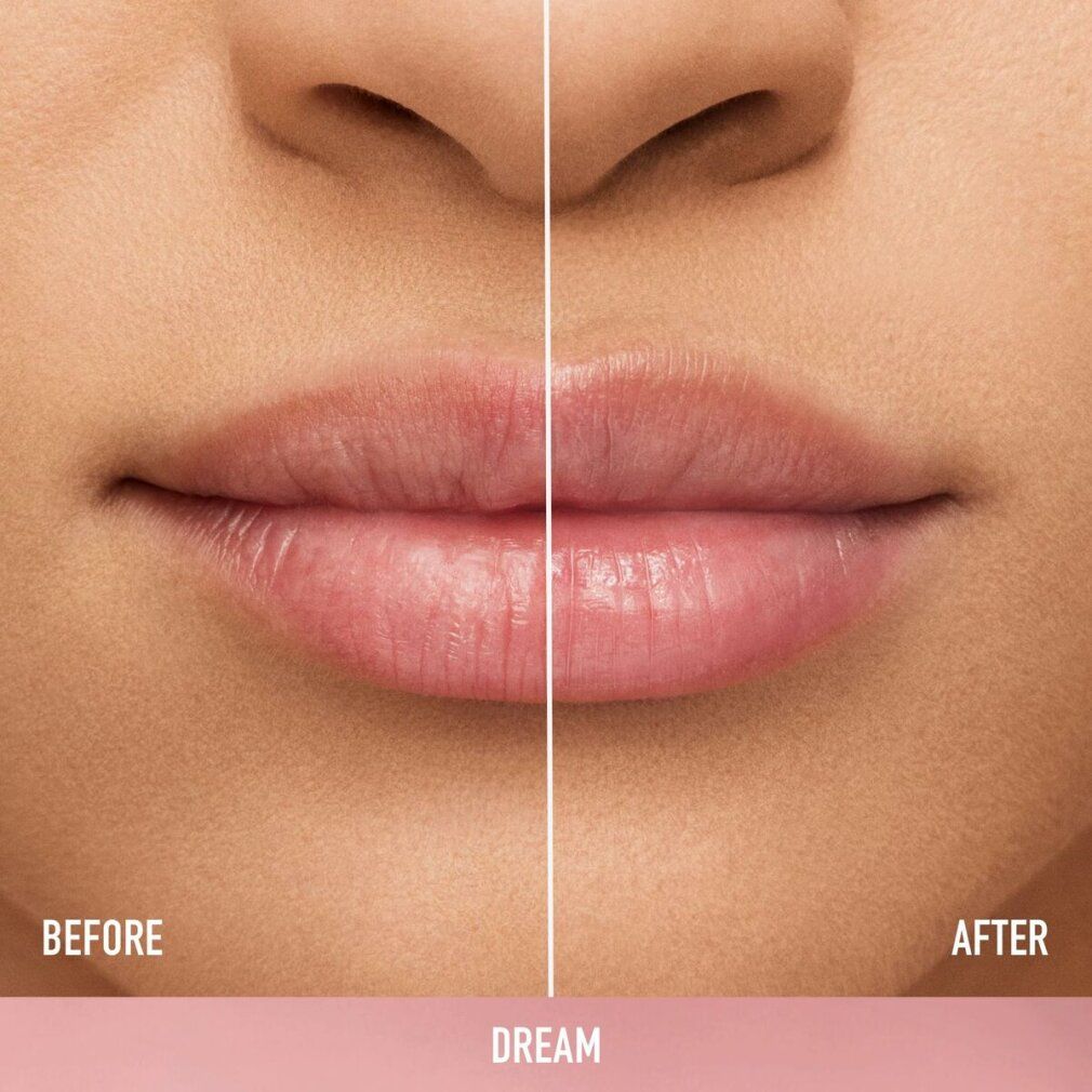 Lippenansicht vor und nach der Anwendung. Text: BEFORE, AFTER, DREAM.