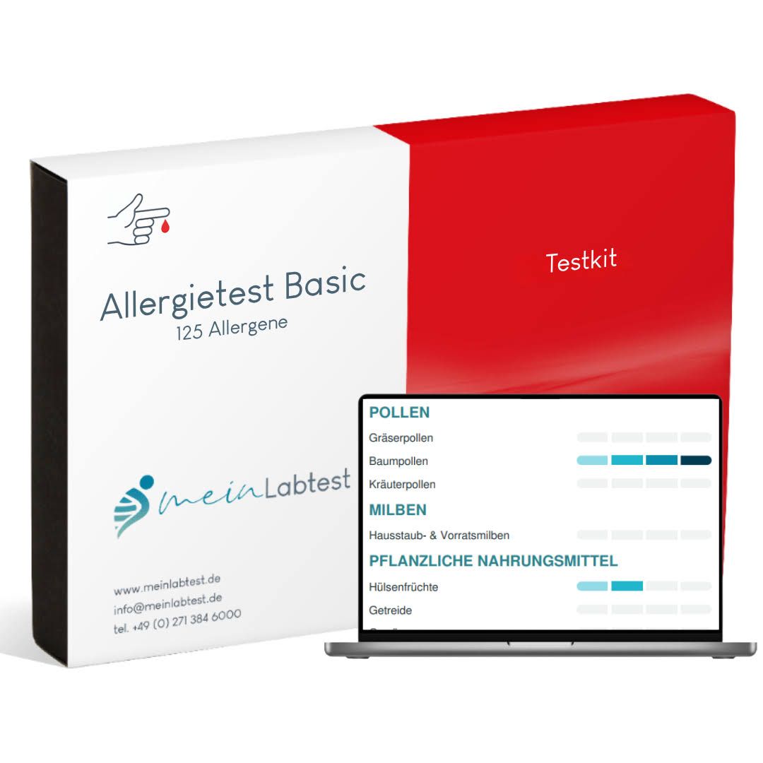 Verpackung des Allergietest Basic neben einem Laptop mit Testergebnissen.