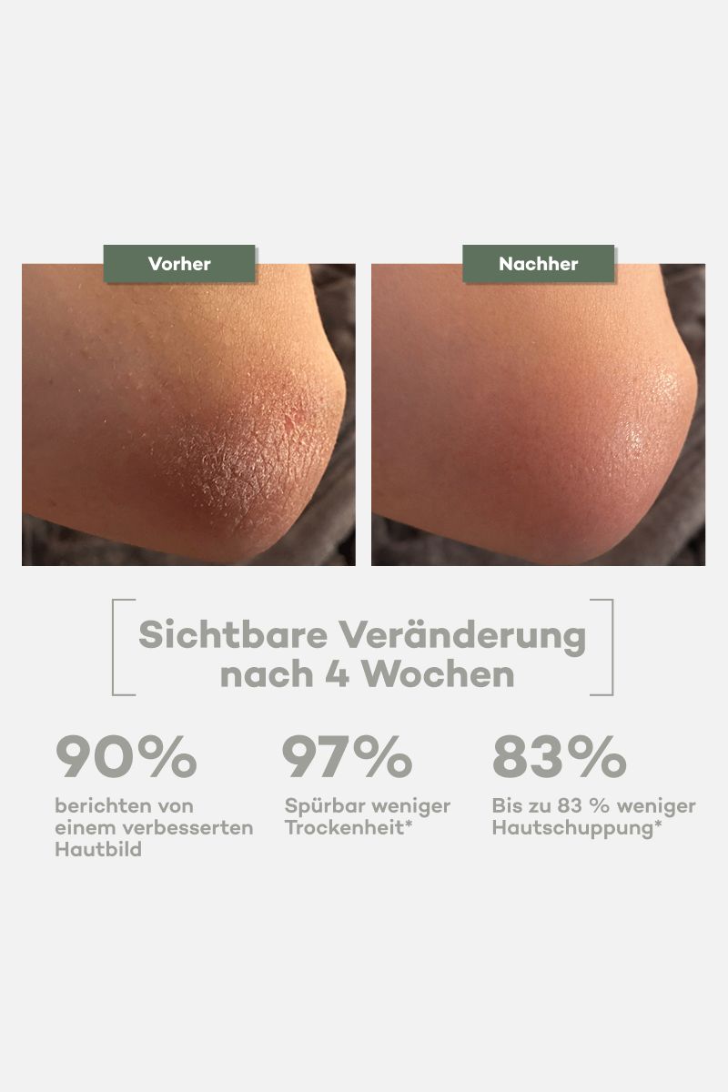 Tallow Body Butter Citrus – Körperpflege bei trockener & empfindlicher Haut – Bio Rindertalg (180ml)