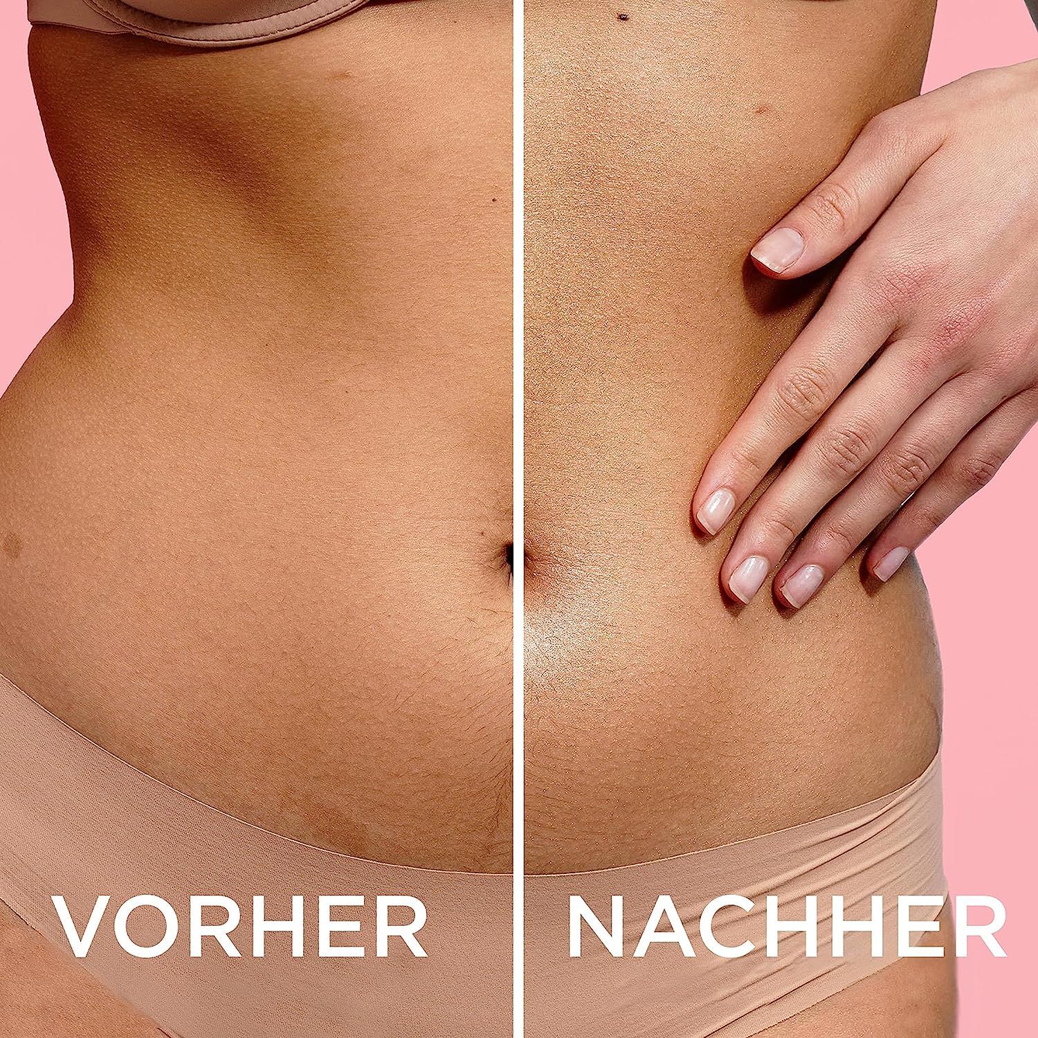 Vorher-Nachher-Ansicht des Bauches einer Frau. Text: Vorher, Nachher.