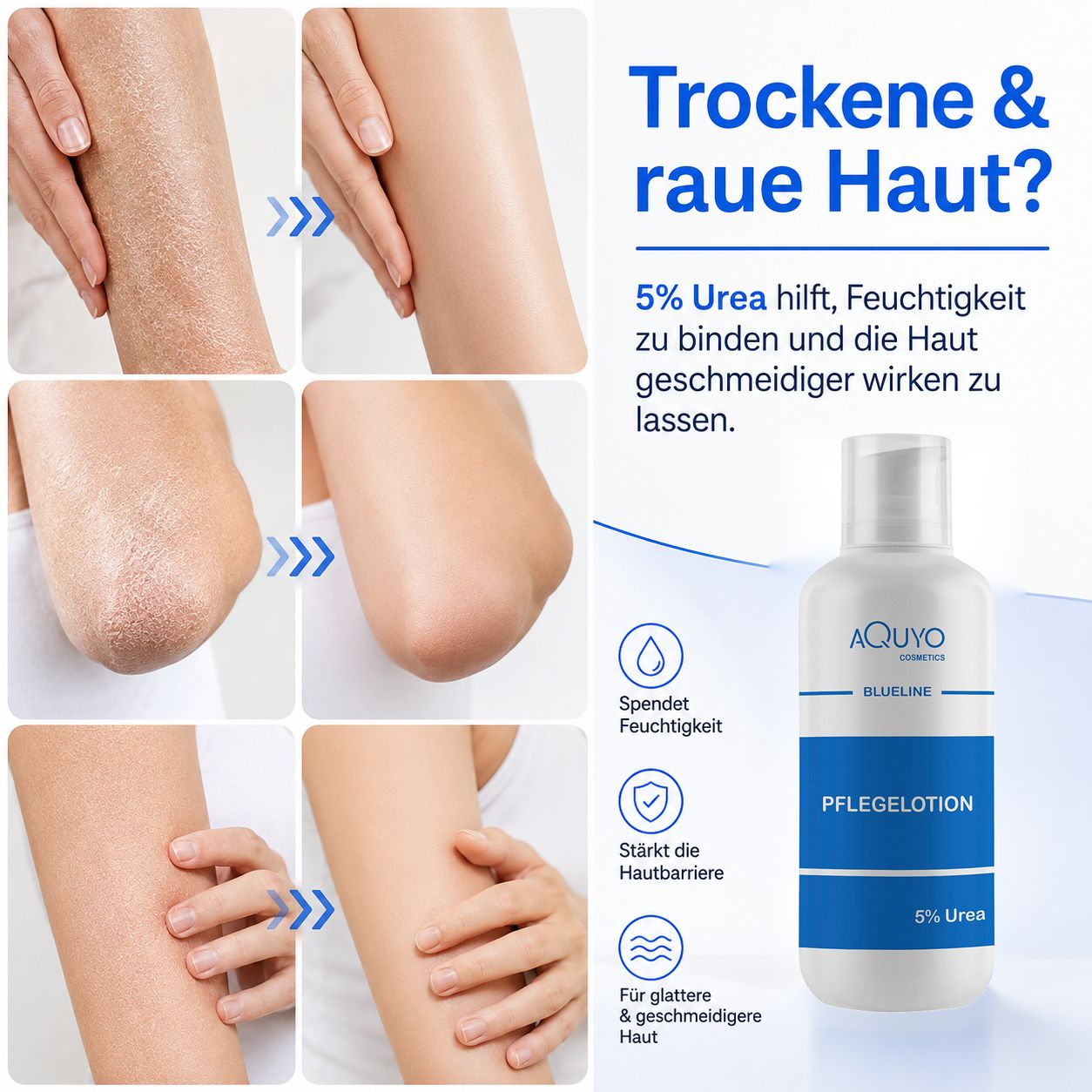 Weiße Flasche mit blauer Aufschrift. Text: 5% Urea, Pflegelotion. Illustrationen von Haut vor und nach der Anwendung.
