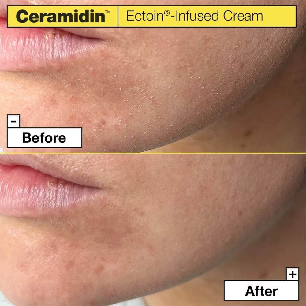 Dr.Jart+ Ceramidin Ectoin-Infused Cream 50 ml Creme