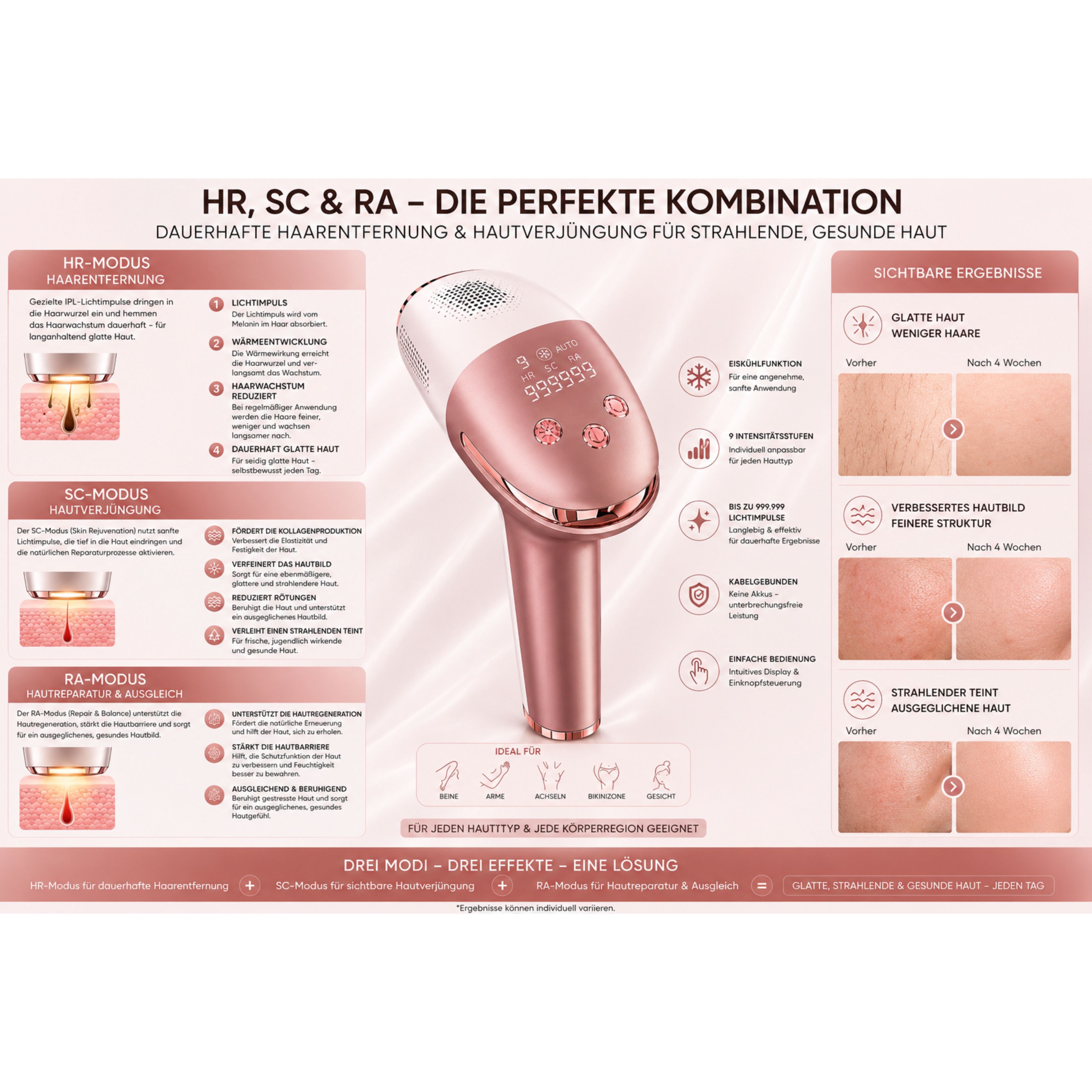 Lalano’S Cosmetics IPL-Haarentferner IceSilk Pro mit Eiskühlfunktion, HR/SC/RA & Auto-Modus