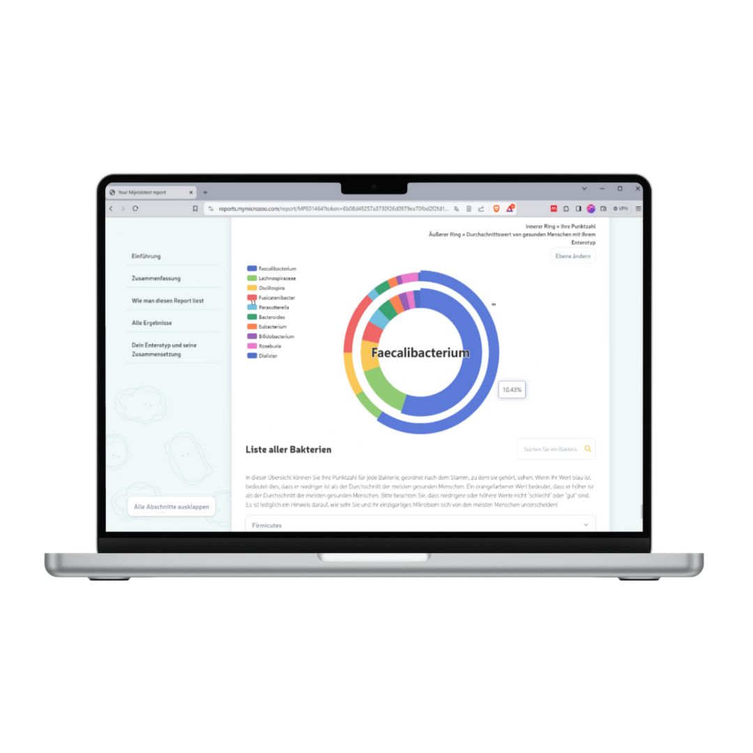 Laptop mit Webseite. Diagramm mit Bakterien. Text: Liste aller Bakterien. Logo und Text auf der linken Seite.