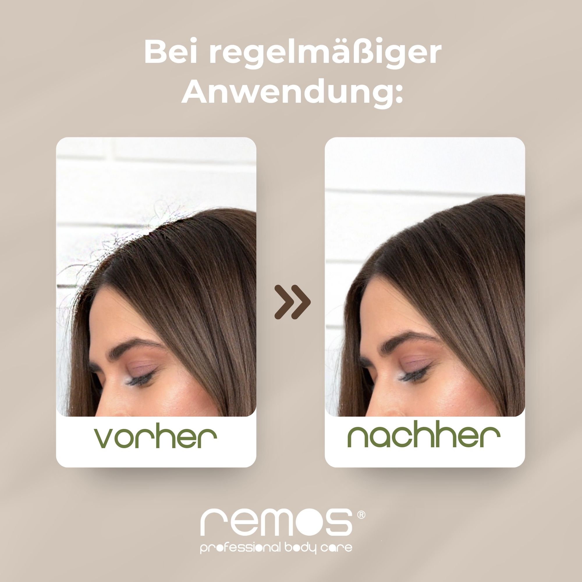 Vorher-Nachher-Vergleich der Haare nach Anwendung der REMOS Haarbürste.