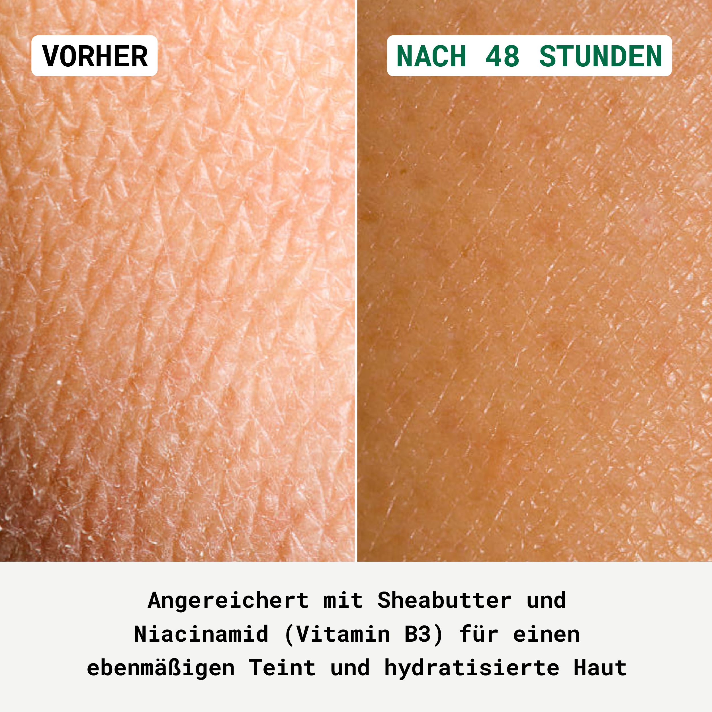 Vorher-Nachher-Vergleich. Haut mit und ohne Creme. Text: Angereichert mit Sheabutter und Niacinamid.