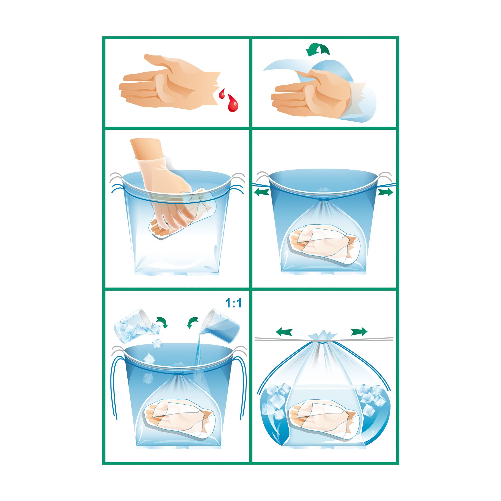 Grafische Darstellung der Anwendung des Beutels. Sechs Schritte: Hand, Wasser, Eis, Beutel im Eimer.