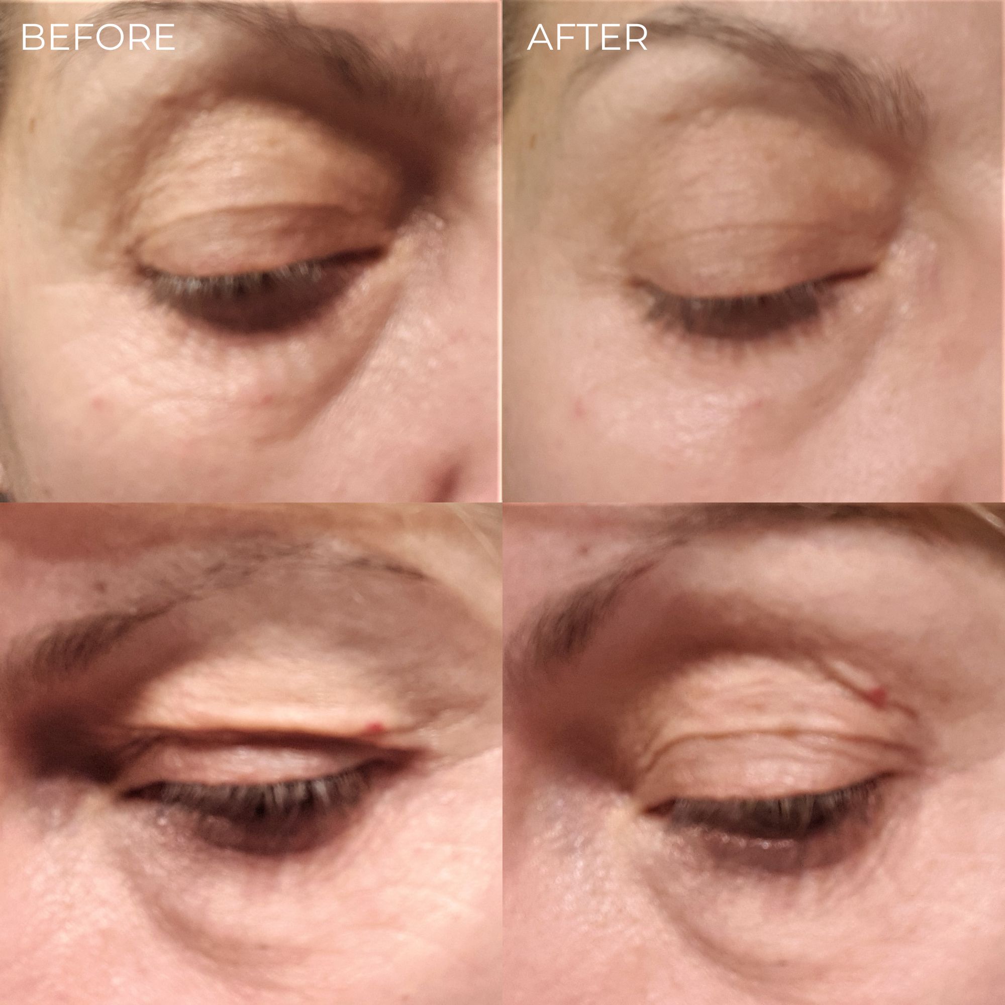 BEAUTICAL Sofort-Lifting Serum