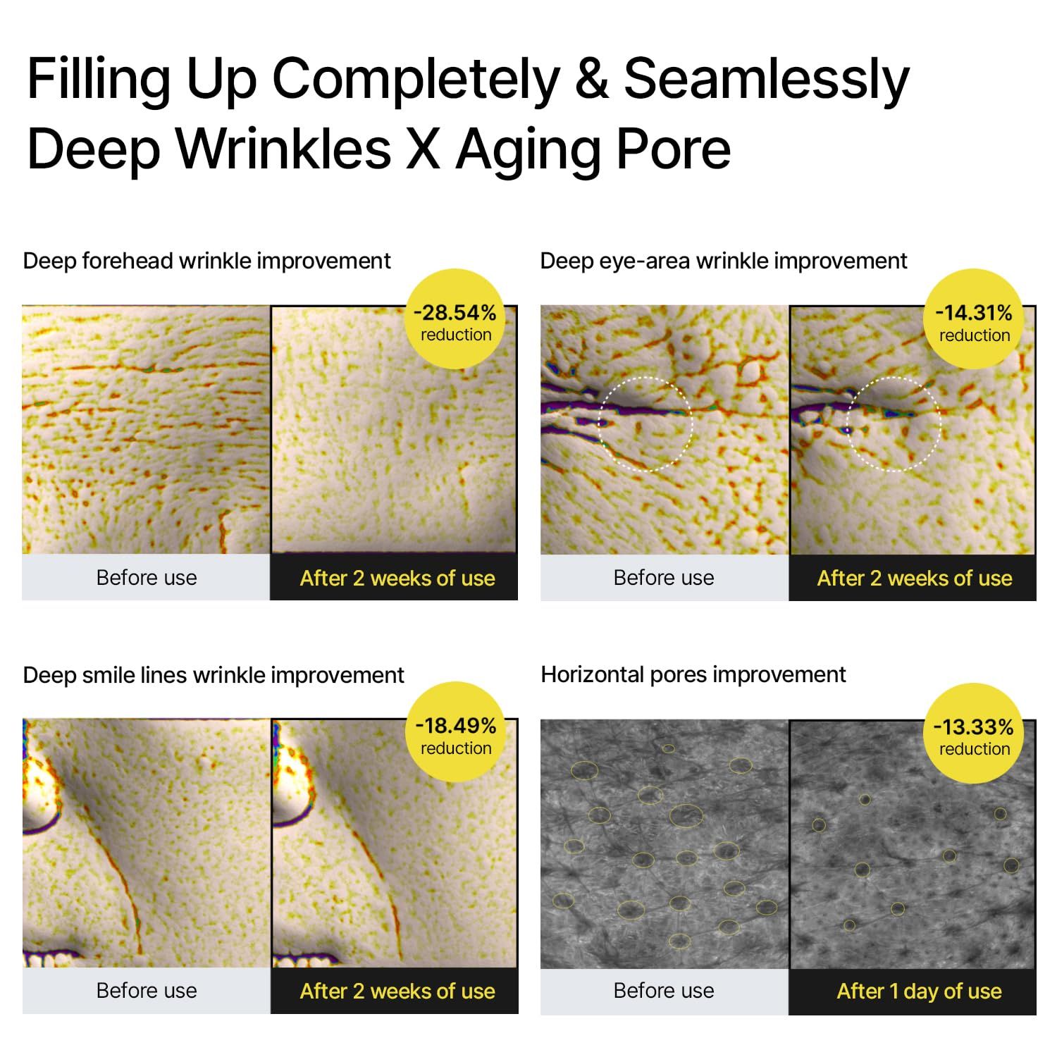 Vorher-Nachher-Bilder zeigen Verbesserungen bei Falten und Poren. Prozentuale Reduzierungen werden angegeben.