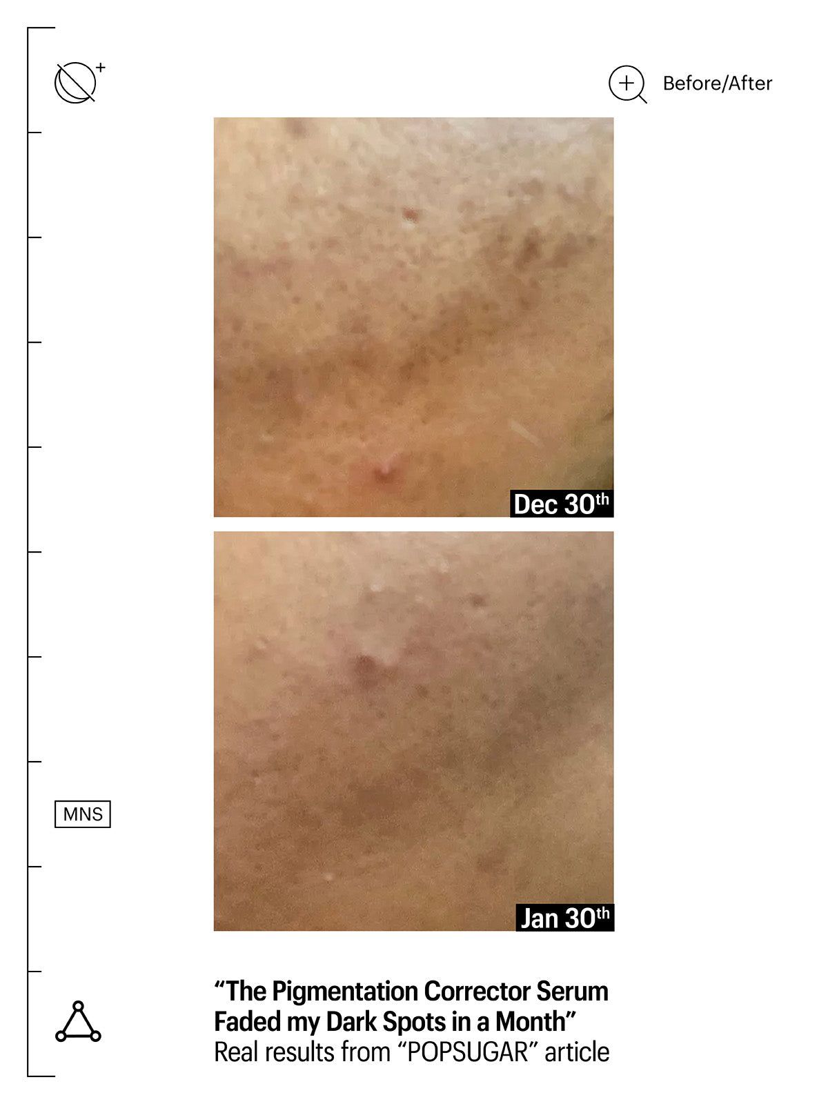 Vorher-Nachher-Vergleich. Zwei Nahaufnahmen von Haut. Text: „The Pigmentation Corrector Serum Faded my Dark Spots in a Month“.