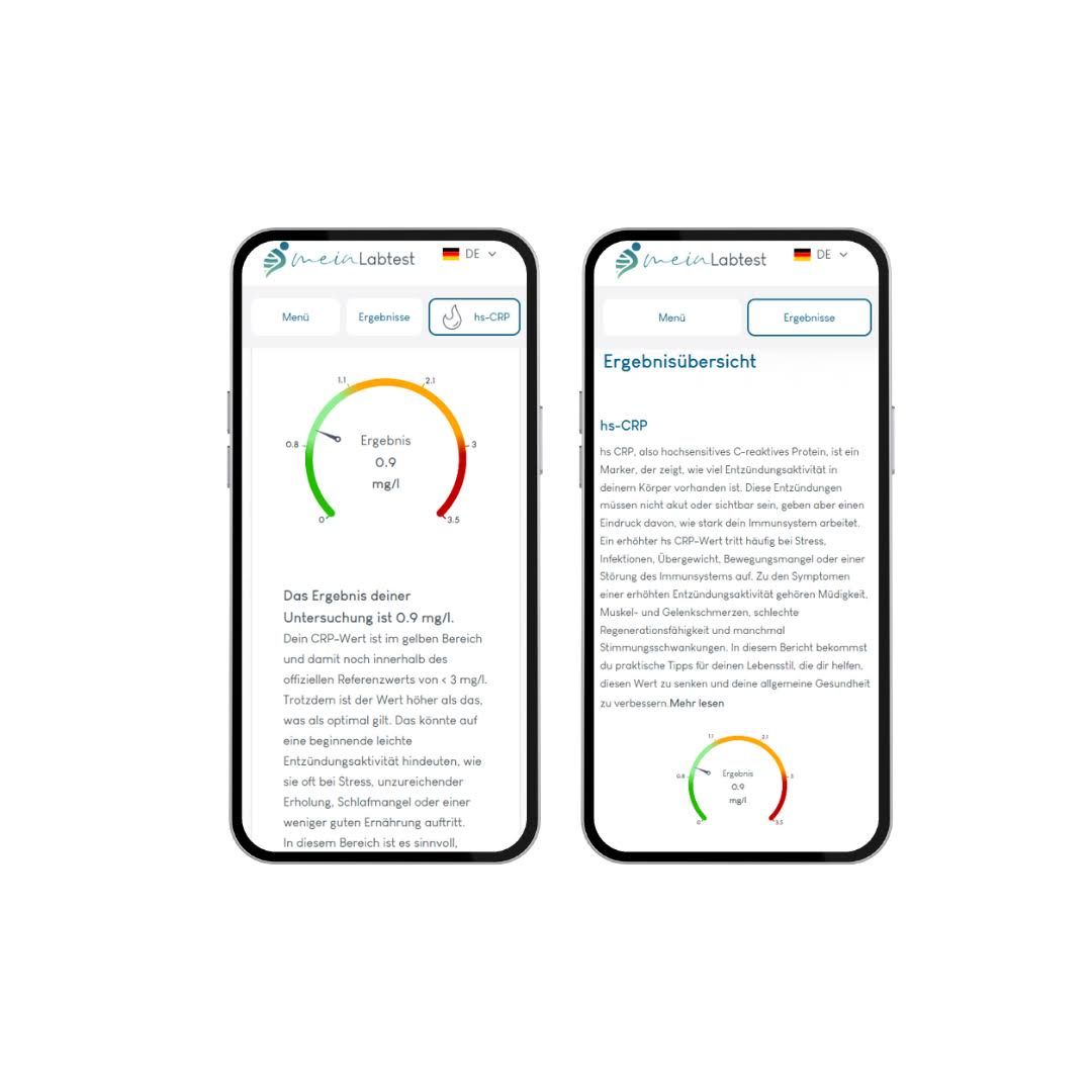 Zwei Smartphones mit Testergebnissen. Farbskala und Text.