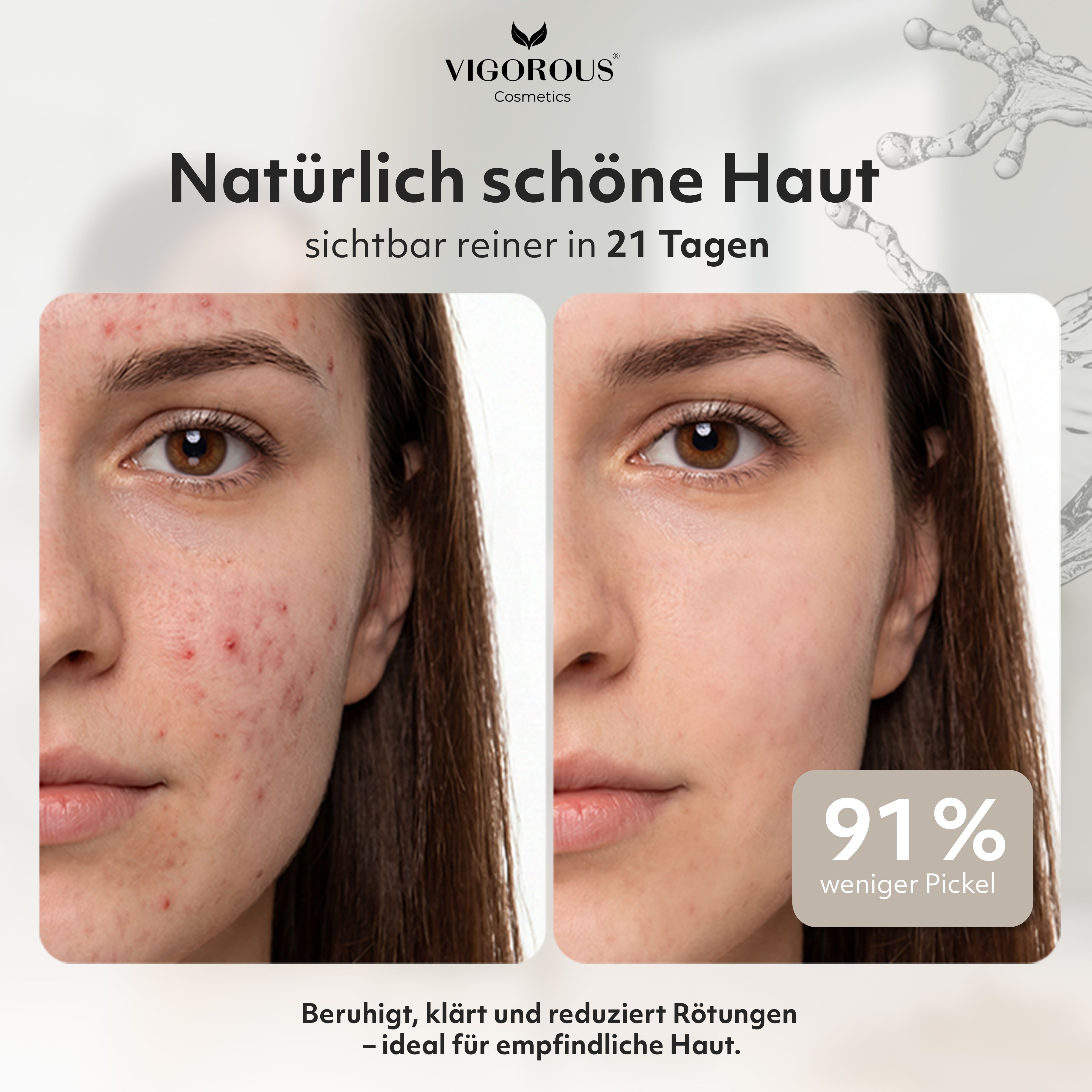 VIGOROUS® Zinkwasser – klärt Poren tiefenrein, bekämpft unreine Haut & Pickel
