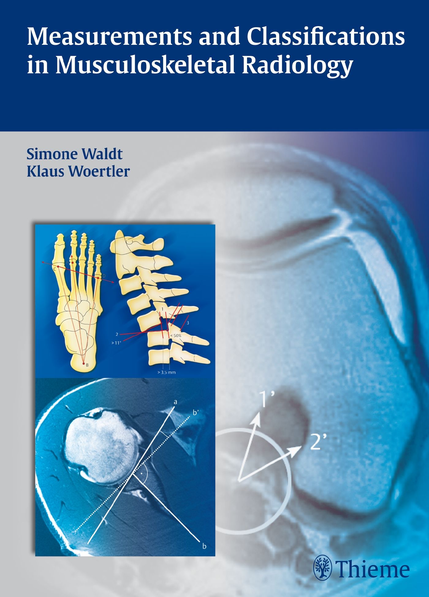 Buchcover: "Measurements and Classifications in Musculoskeletal Radiology". Autoren: Simone Waldt, Klaus Woertler. Verlag Thieme.