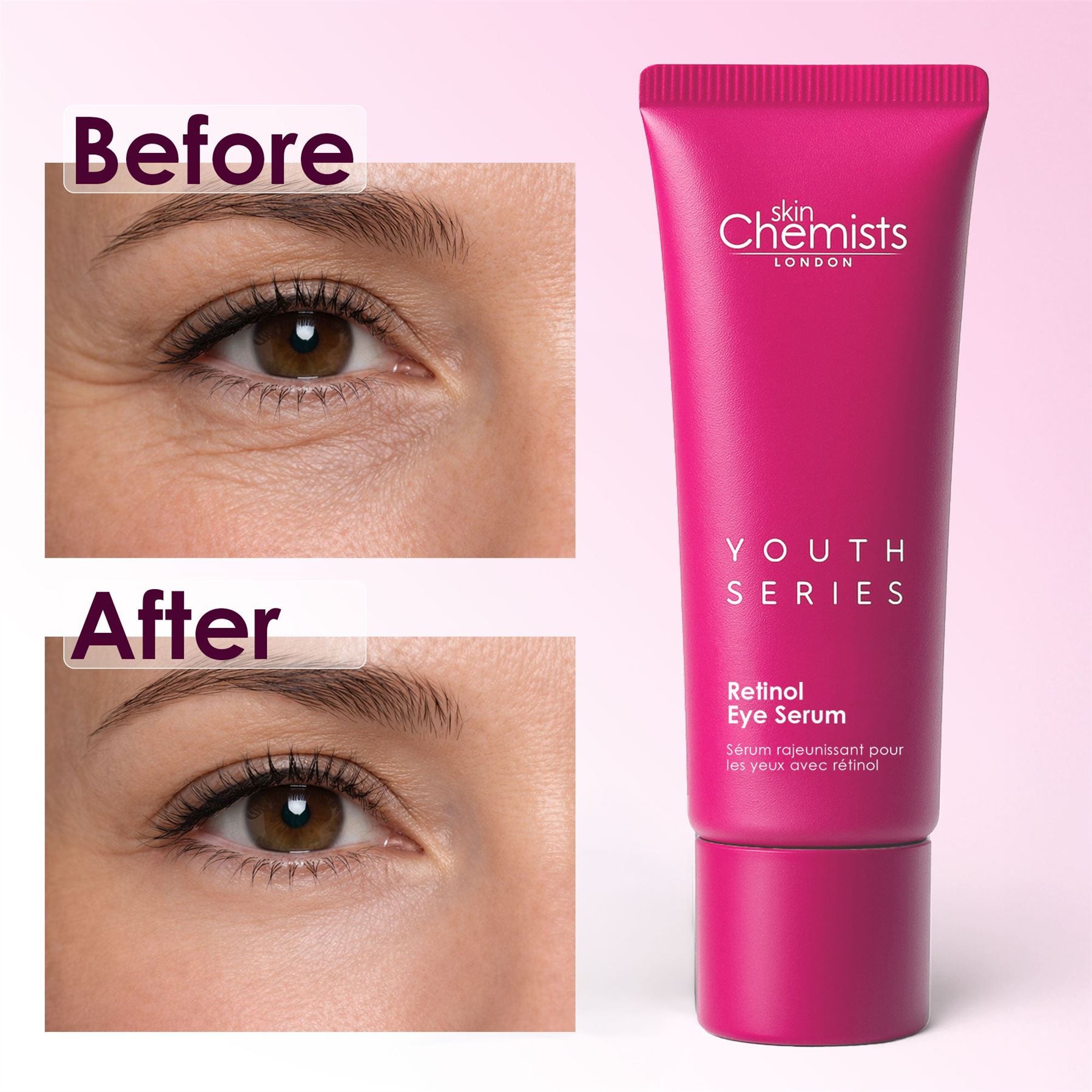SkinChemists Retinol Eye Serum with before and after eye images.